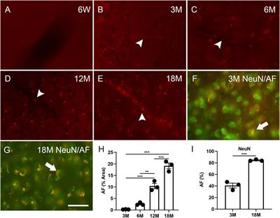 A single dose of lipopolysaccharide elicits autofluorescence in the mouse brain